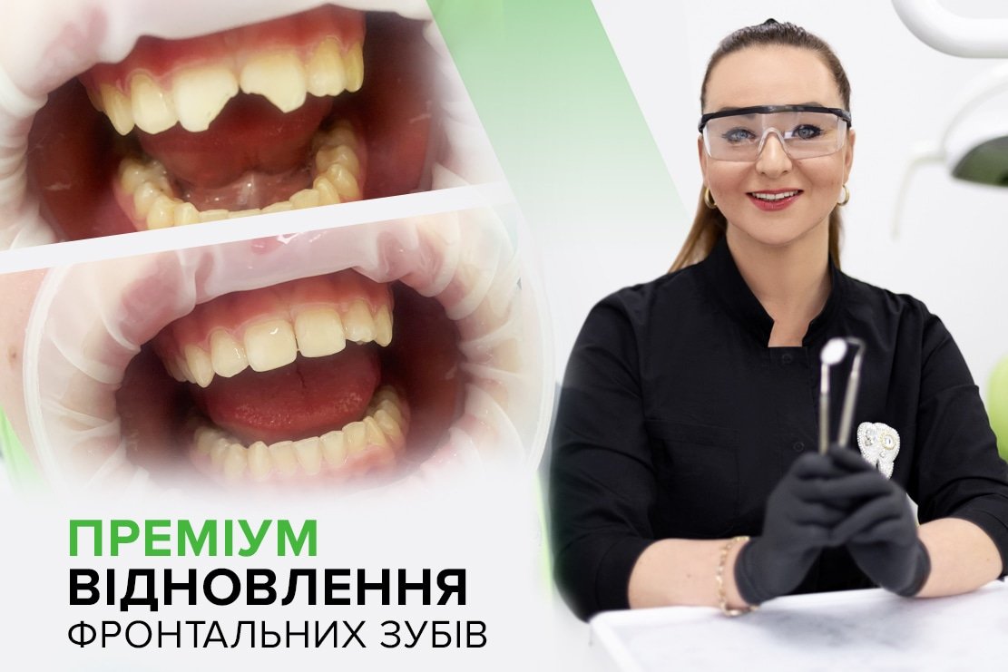 Лікування кореневих каналів ендодонтія